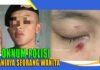 PROPAM POLDA JABAR TAHAN, POLISI ANIAYA WANITA HINGGA LUKA DAN LEBAM